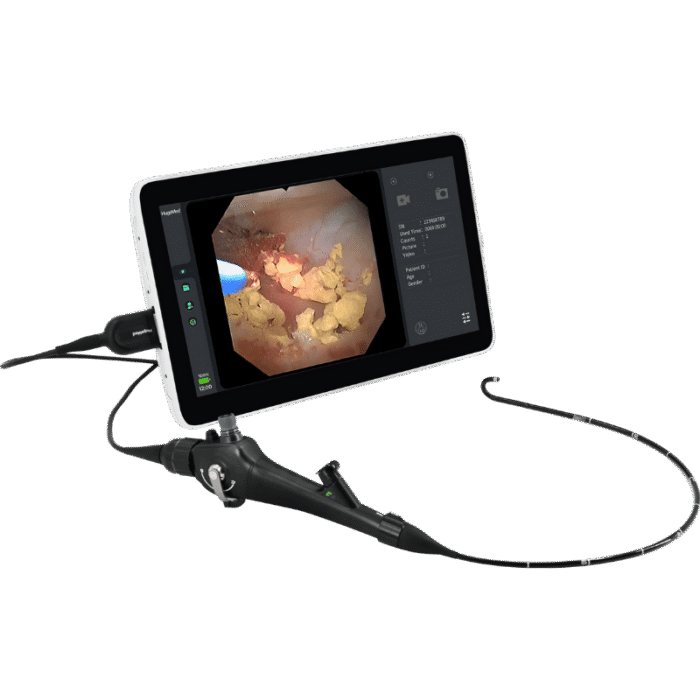 Videoureterorrenoscopio Flexible Reutilizable - Imagen 1